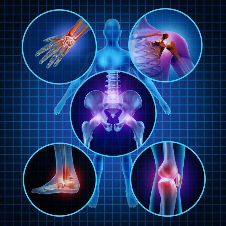 joints affected by arthropathy