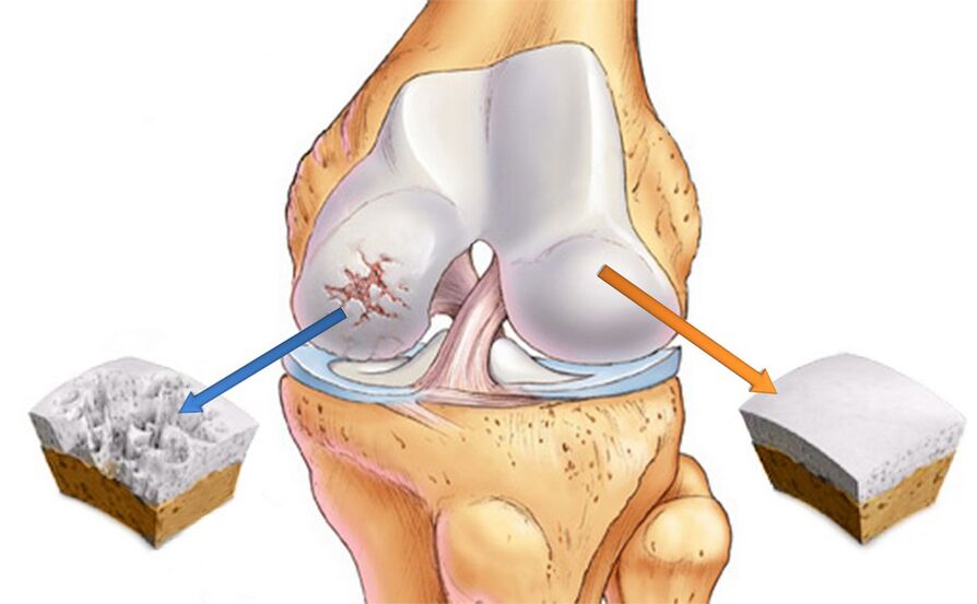Knee joints