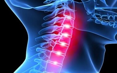 Symptoms of cervical vertebrae