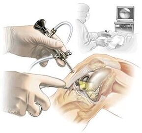 Clarify the diagnosis of medical joints on dashboard