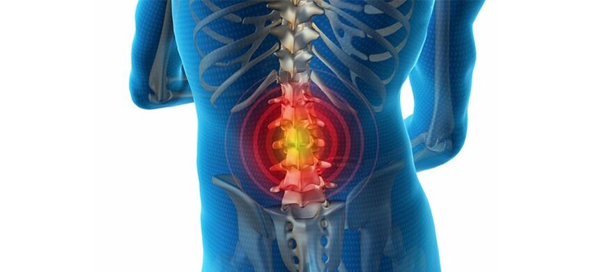 How to Diagnose Back Pain